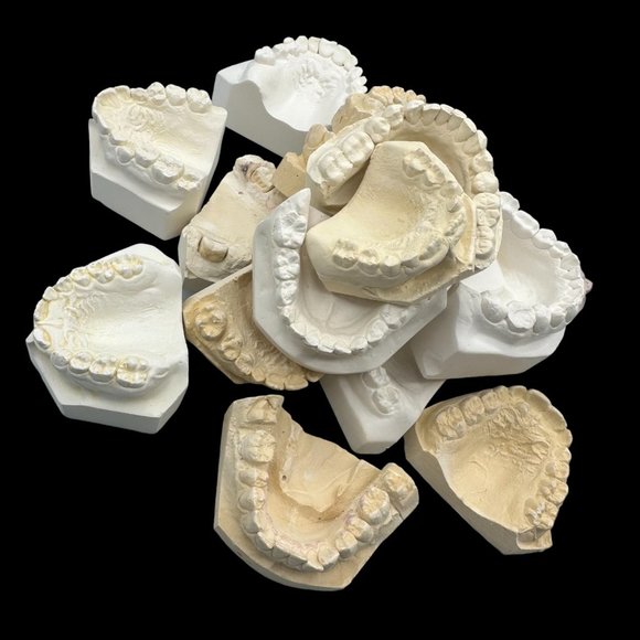 Vintage Plaster Dental Mold - Teeth Tooth Mold - Creepy Oddity - Dental Oddities - Picture 1 of 16